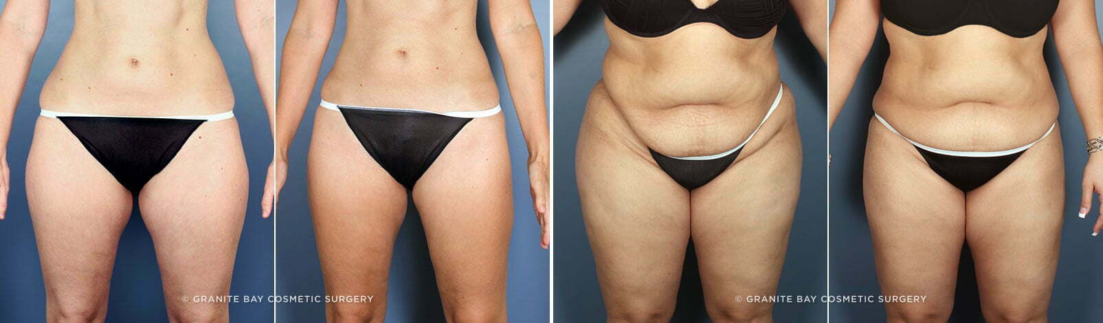 Cosmetic surgery to enhance the overall body - Plastic Surgeon